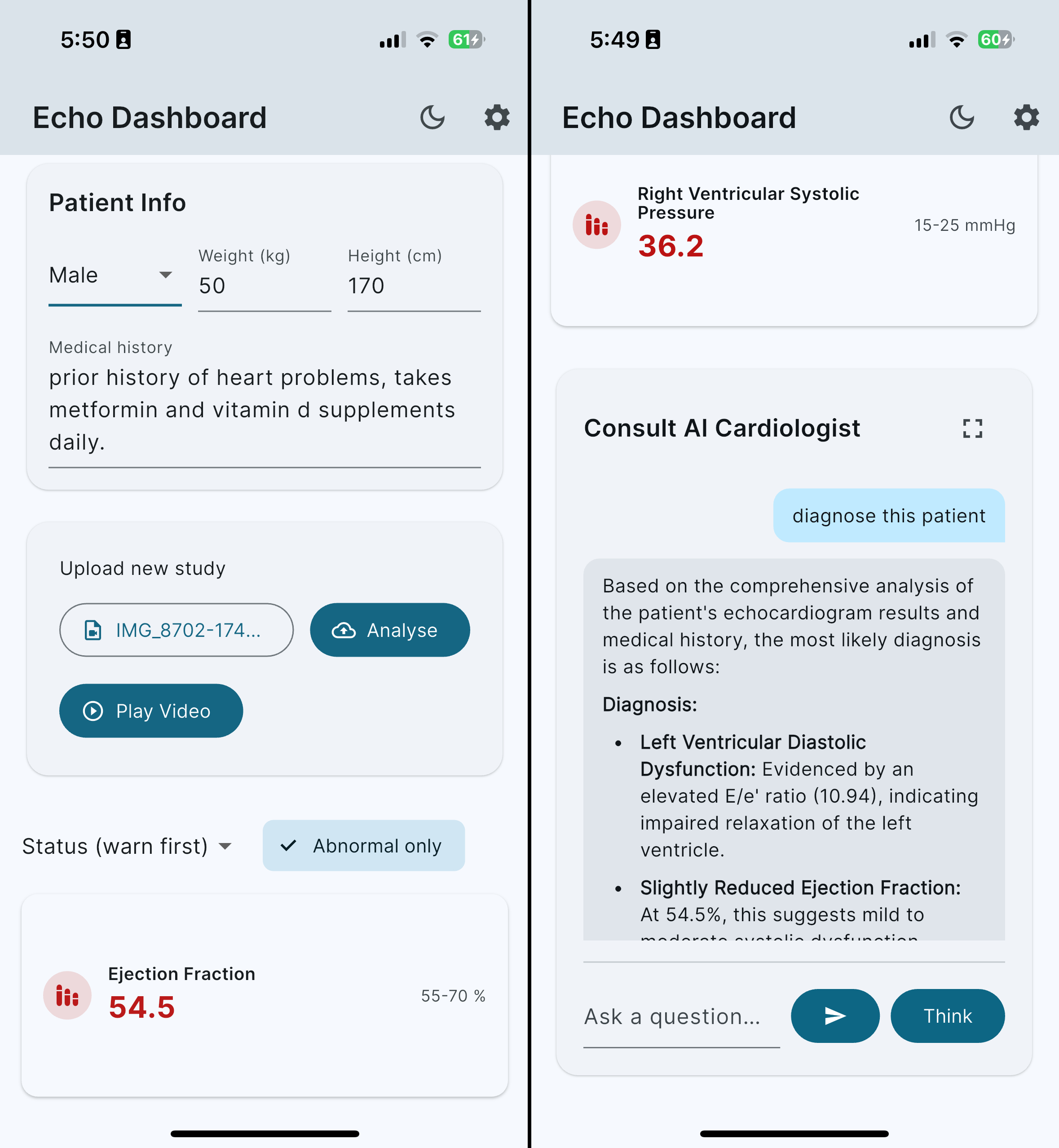 EchoAI Cardiac Analysis